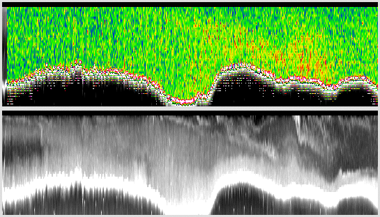vertical section
