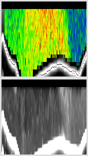 vertical section