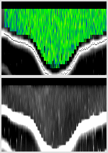 vertical section